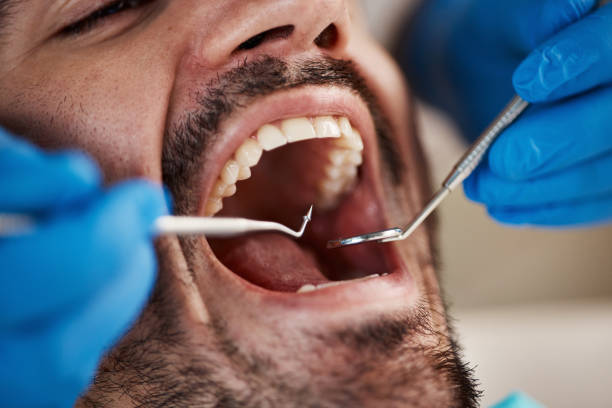 Best Emergency Denture Repair in Tyhee, ID